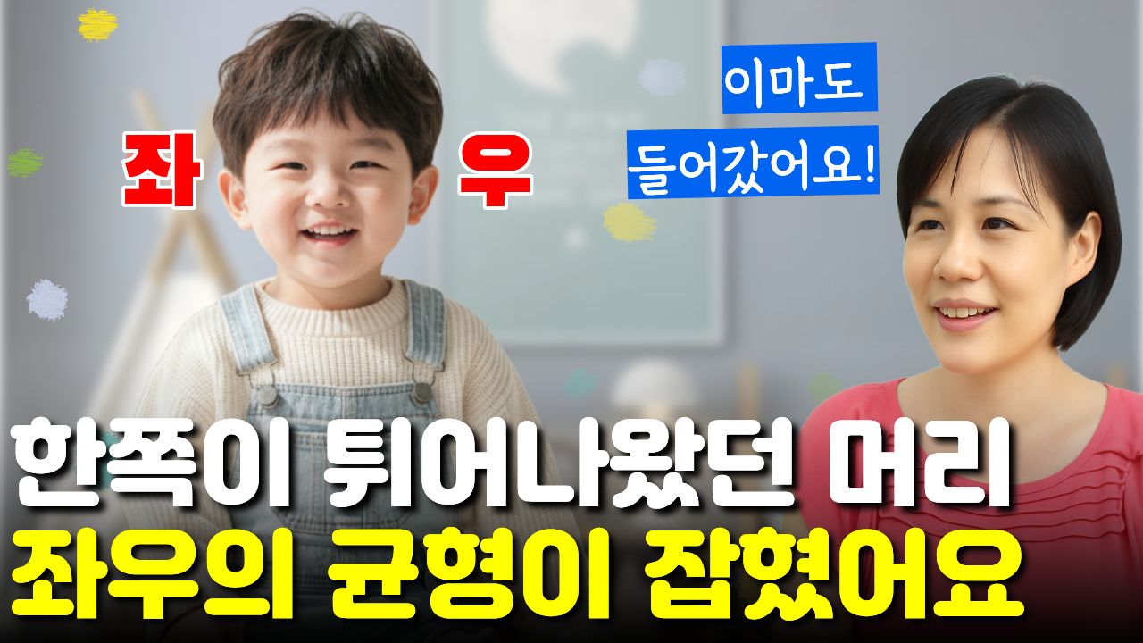 "진공흡입기" 때문에 머리가 튀어나왔는데... 치료 후 "머리 균형이 잡히고" 이마도 들어갔어요