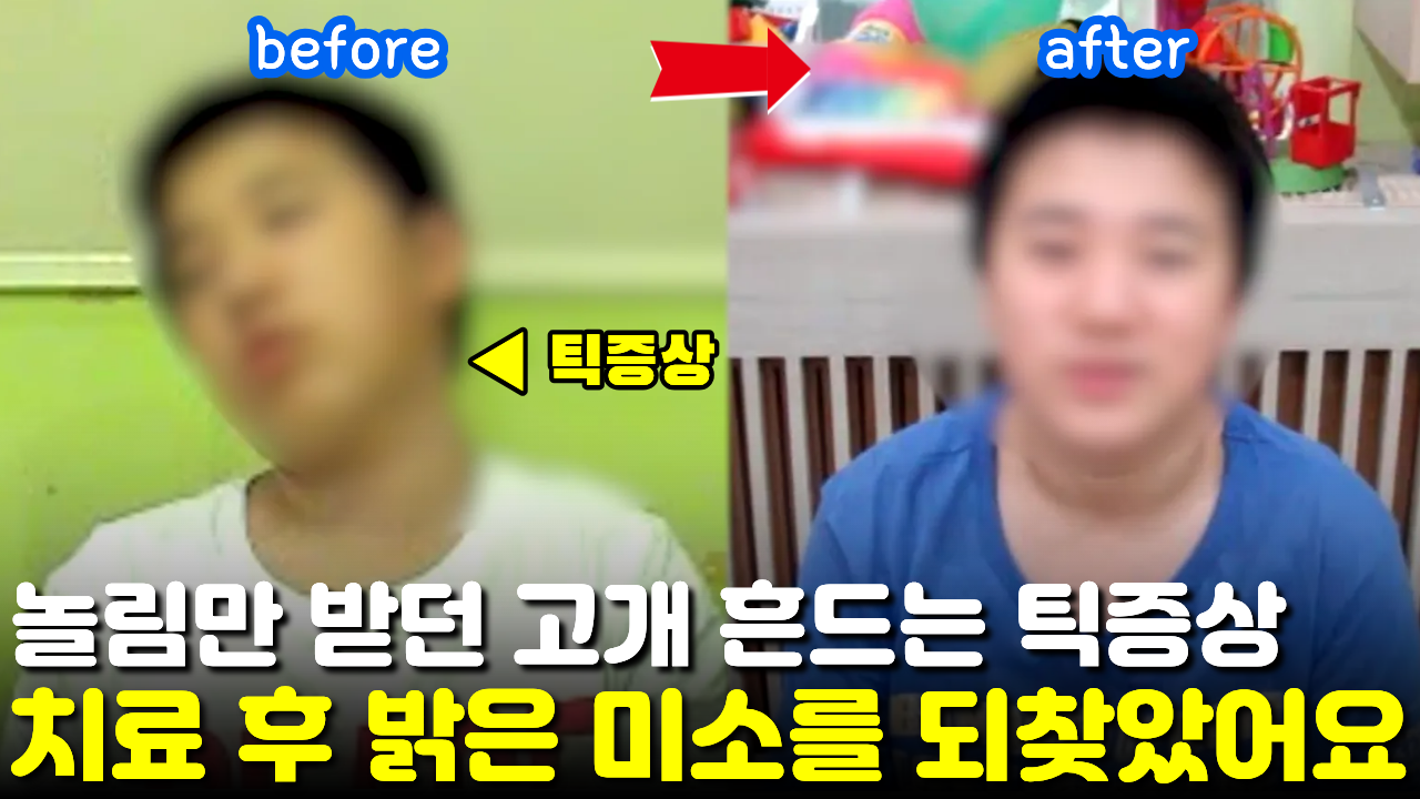 [치료 전후]  틱장애 치료 1년, 대학병원 정신과에서 치료 포기했던 뚜렛증후군 완전히 좋아졌어요. 