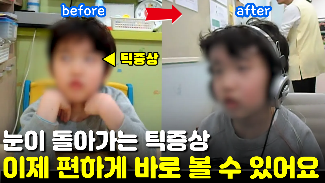 [치료 전후]  눈 돌아는 눈 틱장애, 4개월 치료 후 틱증상 개선되었어요.  